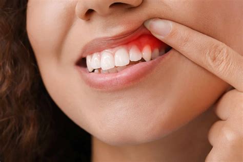 What Does Healthy Gums Look Like: A Journey Through Oral Wellness and Beyond